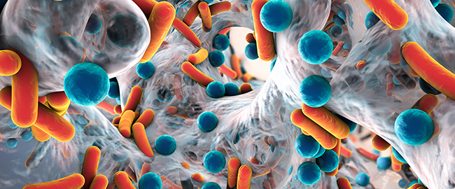 Research Infectious Diseases